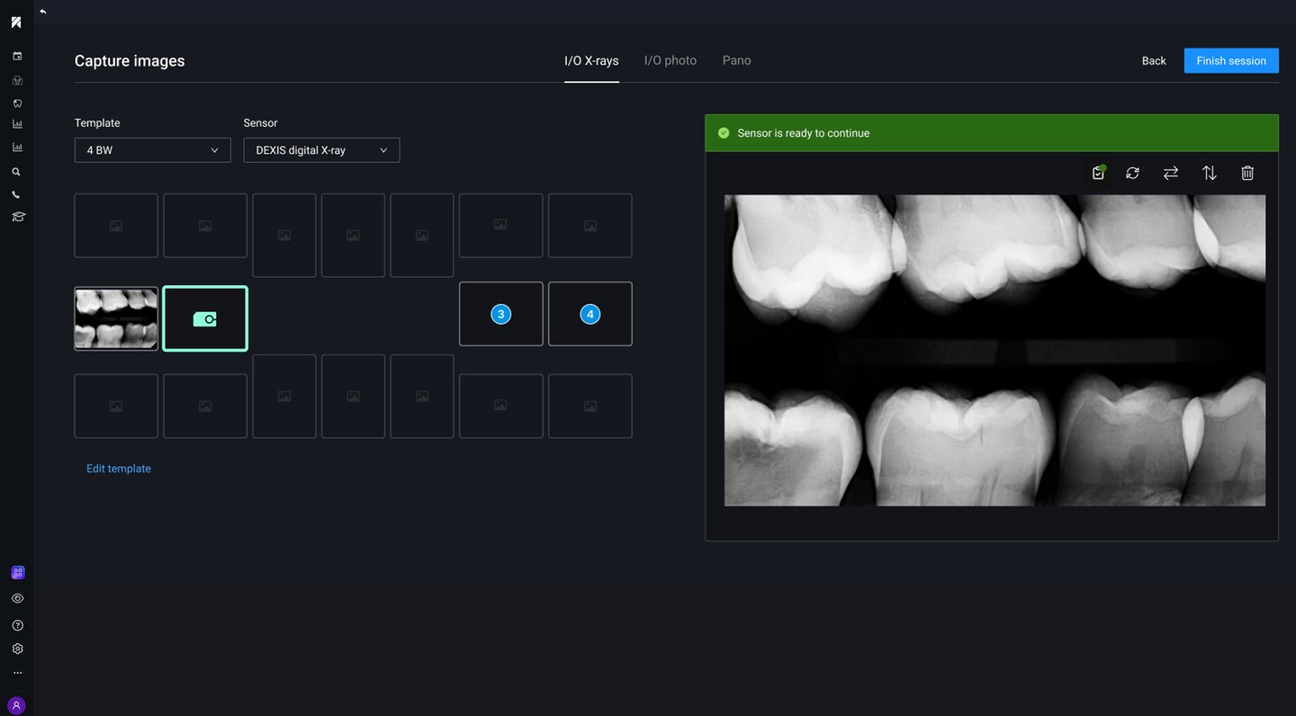 IRIS create new loading screen with enhanced dental imaging workflow
