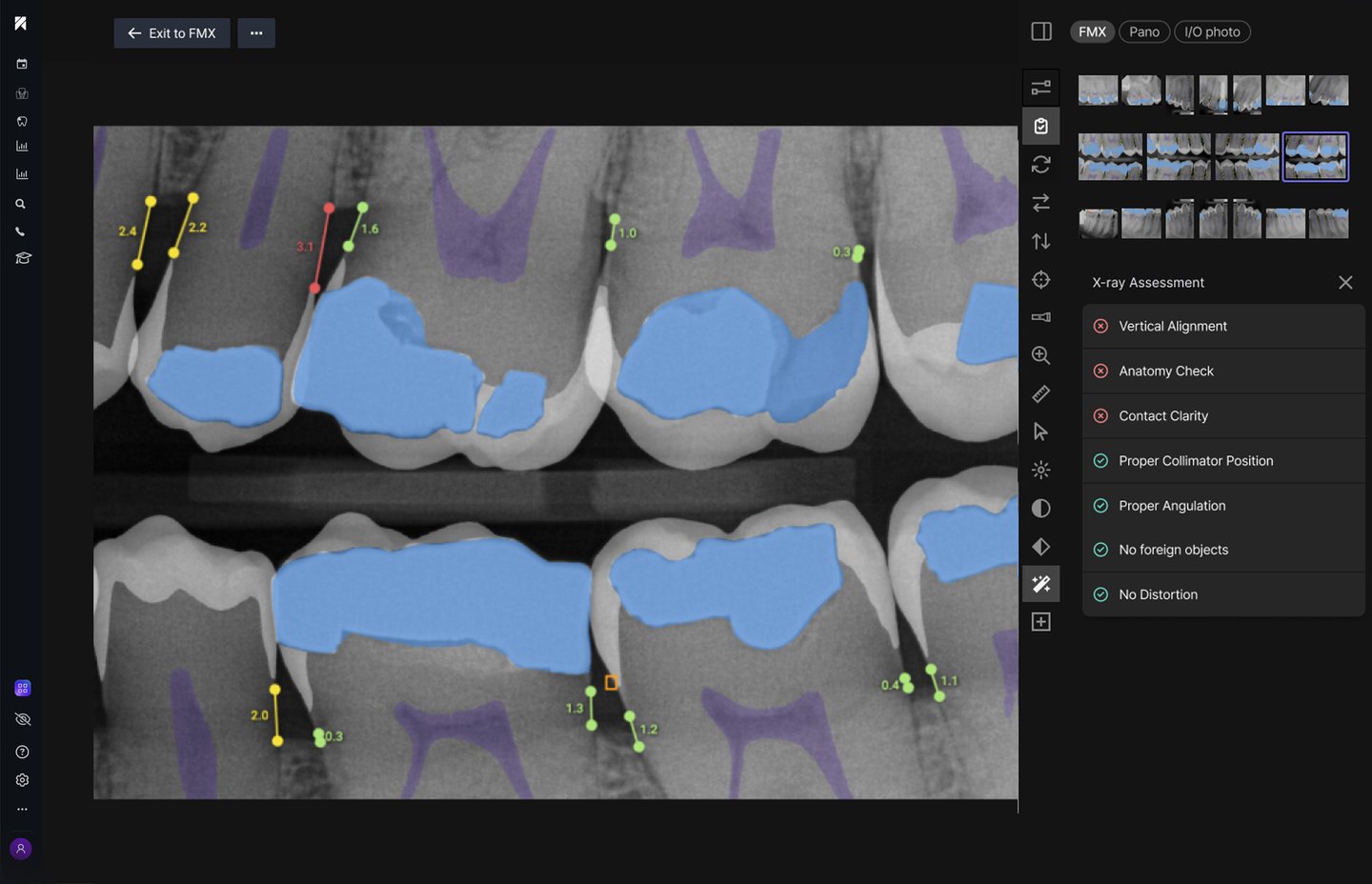 IRIS image quality check interface showing flagged X-ray issues on a dental radiograph