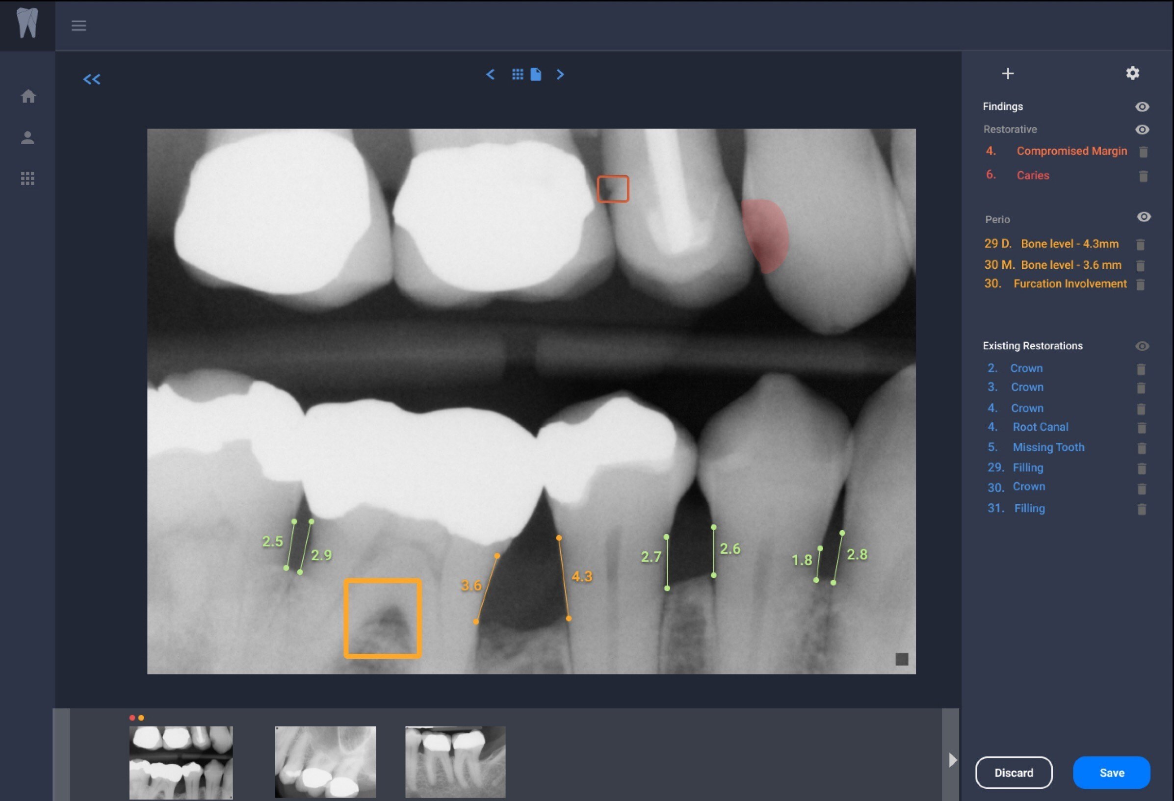 Overjet Dentistry AI imaging Xray